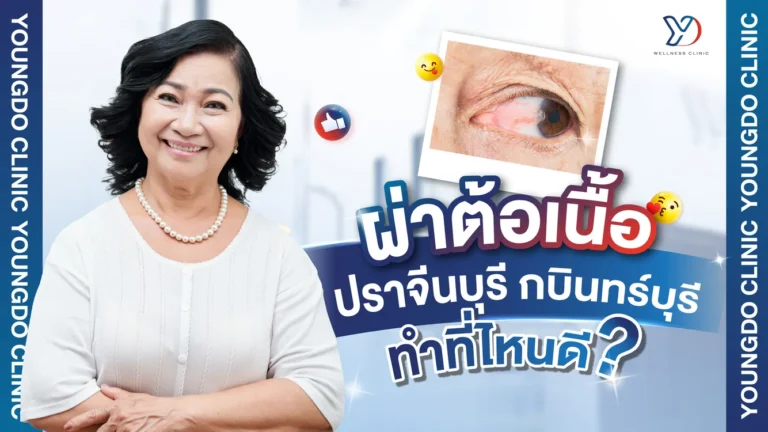 คลินิกผ่าตัดต้อเนื้อที่ปราจีนบุรี