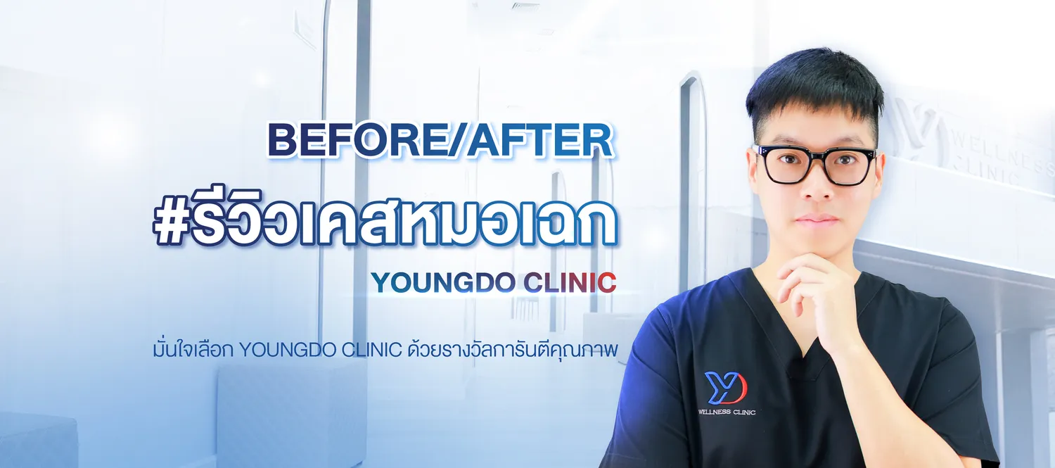 รีวิวเคสหมอเฉก