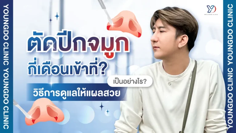 ตัดปีกจมูกกี่เดือนเข้าที่ ดูแลยังไงให้แผลหายไวเรียบสวย