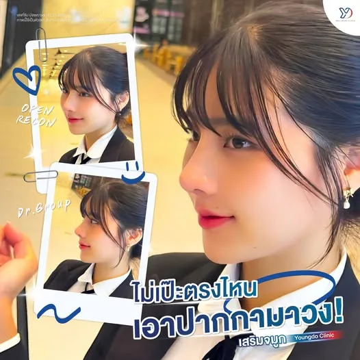 มุมจมูกเป๊ะทุกองศา