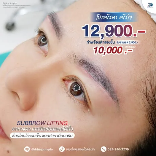 โปรโมชั่นยกหางตา ราคาพิเศษ