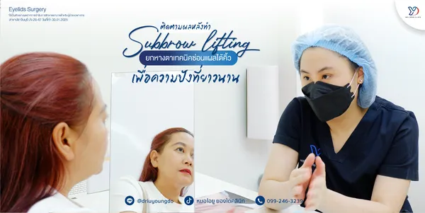 ปรึกษาแพทย์ก่อนทำ Subbrow Lift