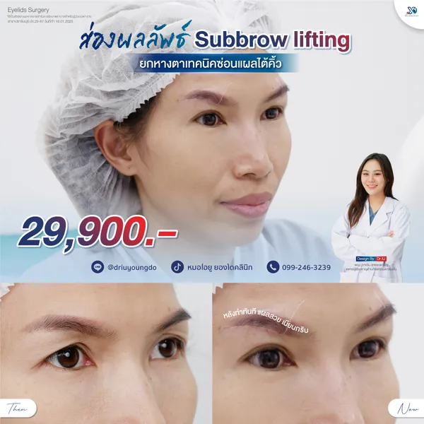 โปรยกหางตาสุดคุ้ม