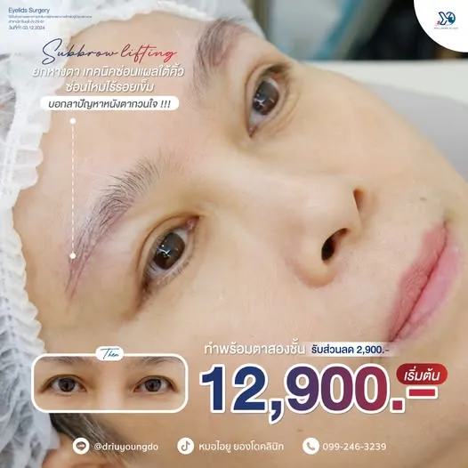 โปรยกหางตา