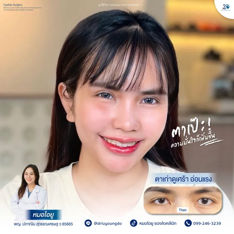 ตาเป๊ะ ความมั่นใจก็เพิ่มขึ้น