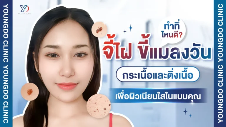 จี้ไฝ ขี้แมลงวัน กระเนื้อและติ่งเนื้อ ที่ไหนดี เพื่อผิวเนียนใสในแบบคุณ