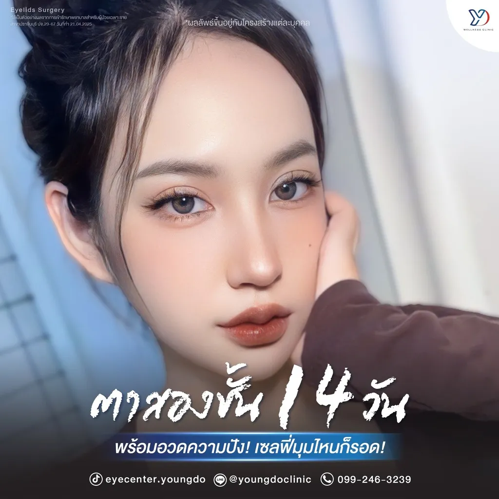รีวิวตาสองชั้นยองโด-30