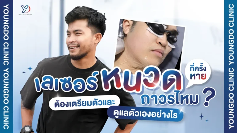 เลเซอร์หนวดกี่ครั้งเห็นผล อยู่ได้ถาวรไหมพร้อมวิธีเตรียมตัวและดูแลผิว