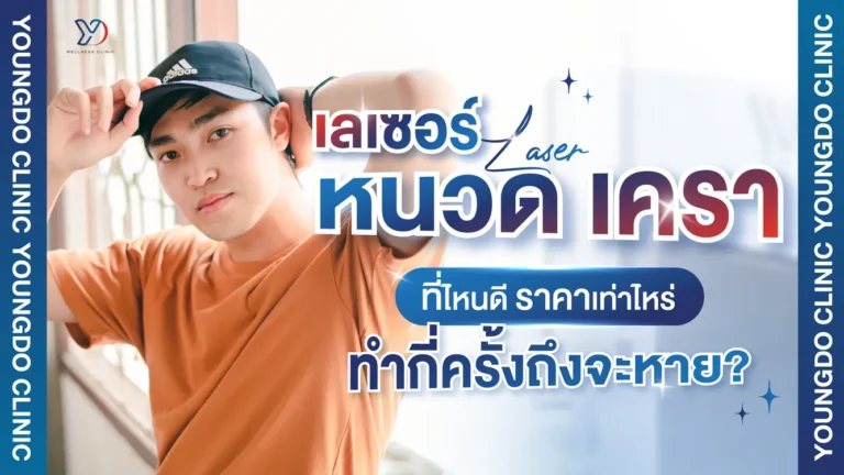 คลินิกเลเซอร์หนวด เครา ที่ไหนดี ราคาเท่าไร ทำกี่ครั้งถึงจะหาย