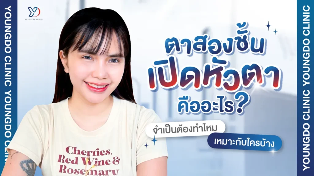 ทำตาสองชั้นเปิดหัวตา คืออะไร จำเป็นไหม เช็กลิสต์ใครบ้างที่ควรทำ