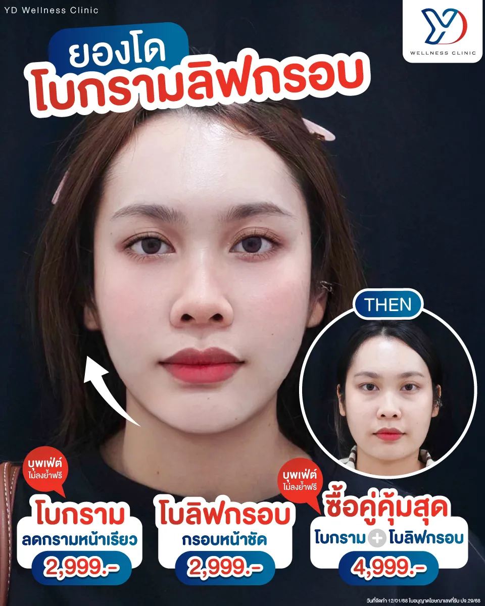โบท็อกซ์ลดกรามและยกกระชับกรอบหน้า ก่อน-หลัง