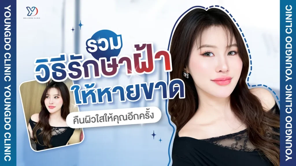 วิธีรักษาฝ้าให้หายขาดทำอย่างไร รวมทุกเคล็ดลับคืนผิวใสที่คุณต้องรู้