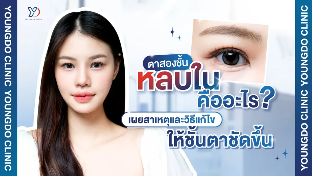 ตาสองชั้นหลบในคืออะไร ชวนดูสาเหตุ และวิธีแก้ไขให้ชั้นตาสวยชัด