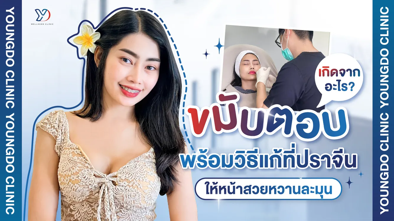 ขมับตอบเกิดจากอะไร พร้อมวิธีแก้ขมับตอบที่ปราจีน ให้หน้าสวยหวานละมุนขึ้น