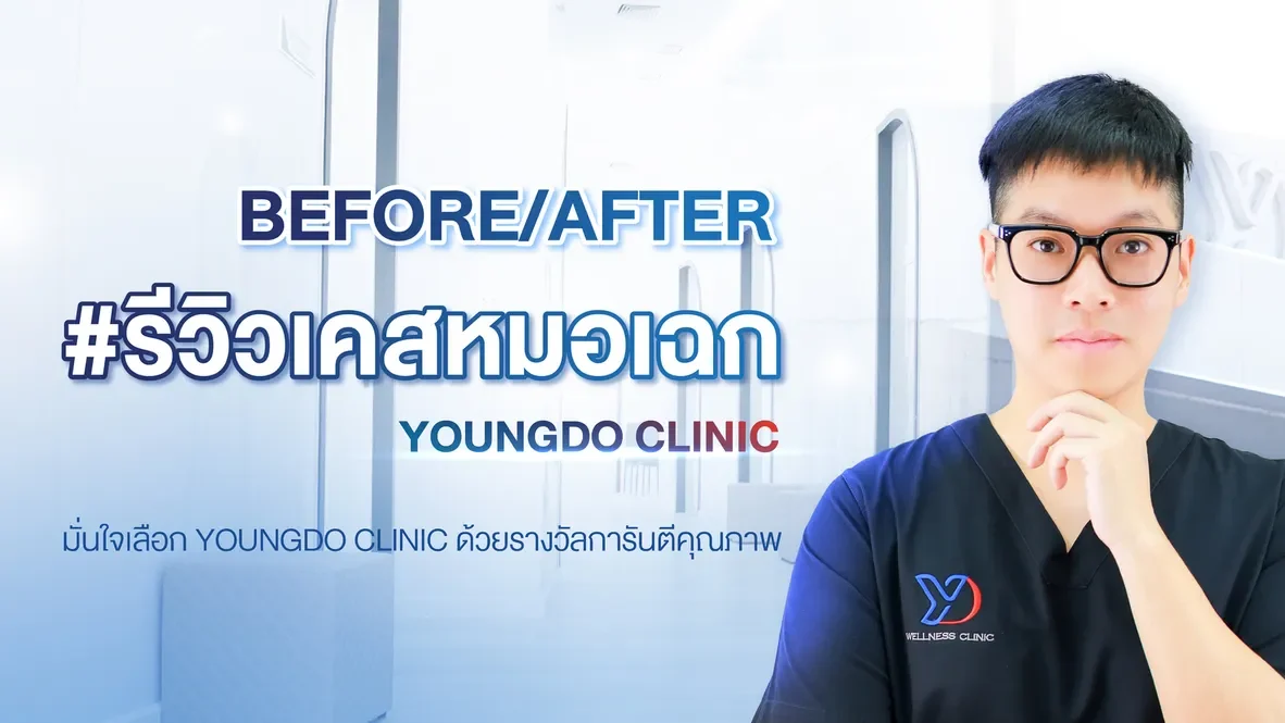 รีวิวเคสหมอเฉก