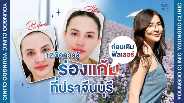 12 ข้อควรรู้ก่อนเติมฟิลเลอร์ร่องแก้ม ที่ปราจีนบุรี