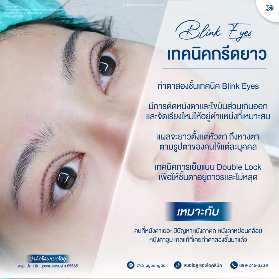 เทคนิค Blink Eyes กรีดยาว