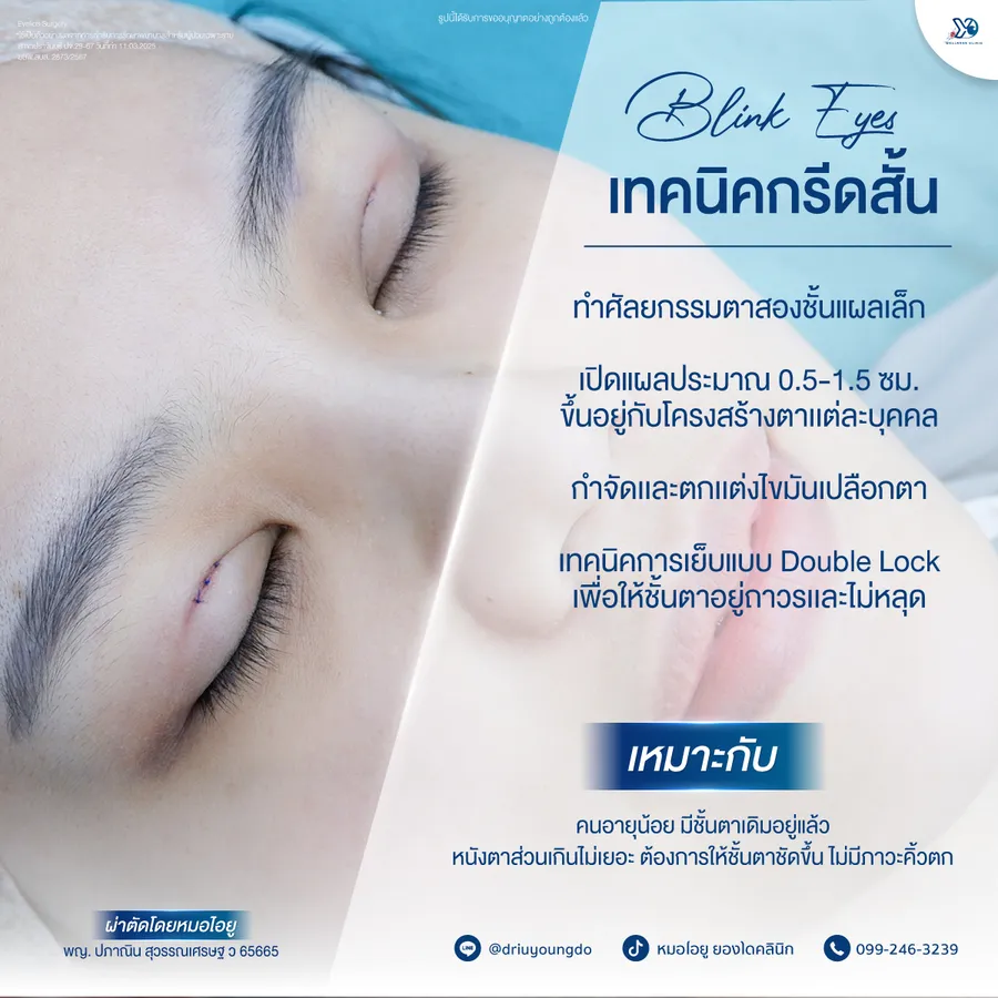 เทคนิค Blink Eyes กรีดสั้น