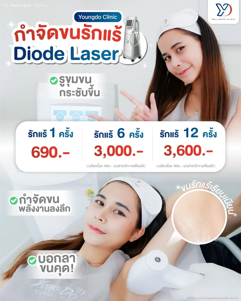 ราคา Diode Laser กำจัดขนรักแร้