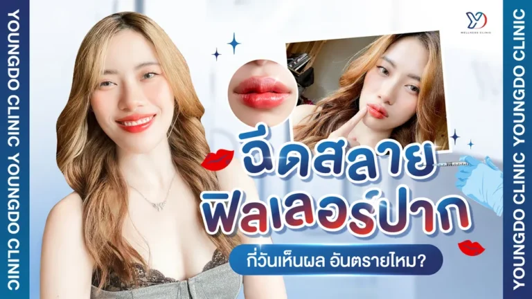 ฟิลเลอร์ปากเป็นก้อน วิธีแก้ฟิลเลอร์ปาก กี่วันเห็นผล ปลอดภัยไหม