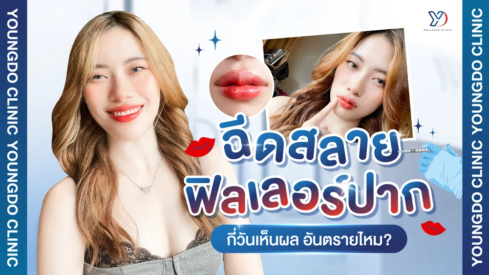 ฟิลเลอร์ปากเป็นก้อน วิธีแก้ฟิลเลอร์ปาก กี่วันเห็นผล ปลอดภัยไหม