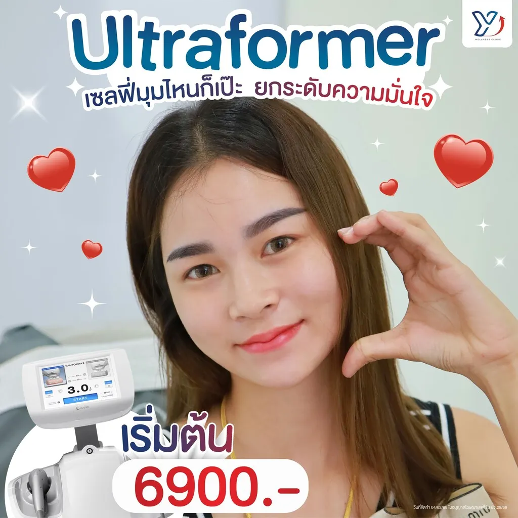 Ultraformer ยกกระชับเพิ่มความมั่นใจ
