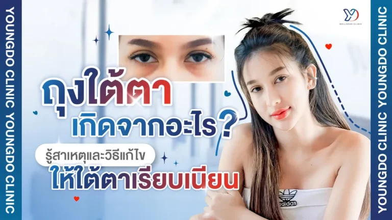 ถุงใต้ตาเกิดจากอะไร? รู้สาเหตุและวิธีแก้ไขให้ใต้ตาเรียบเนียน