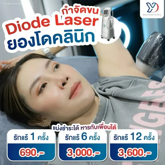 ราคา Diode Laser กำจัดขนรักแร้ (มุมใกล้)