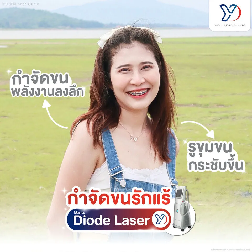 ผลลัพธ์ Diode Laser กำจัดขนรักแร้