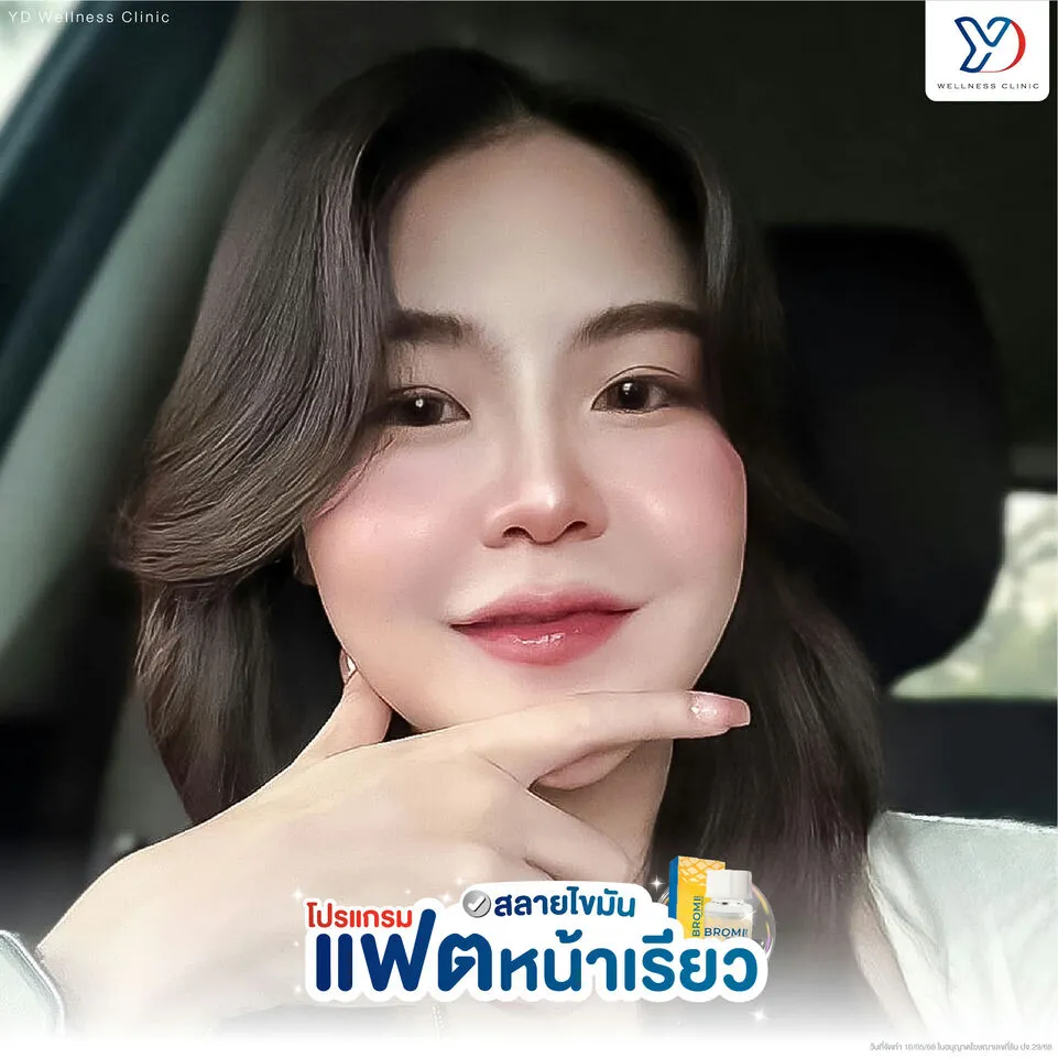 โปรแกรมสลายไขมัน แฟตหน้าเรียว