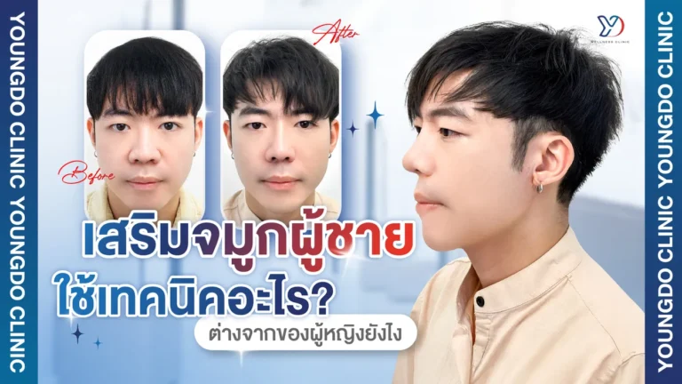 เสริมจมูกผู้ชายใช้เทคนิคอะไร? ต่างจากของผู้หญิงยังไง