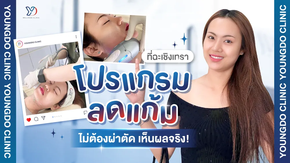 แนะนำโปรแกรมลดแก้มที่ฉะเชิงเทรา ไม่ต้องผ่าตัด เห็นผลจริง