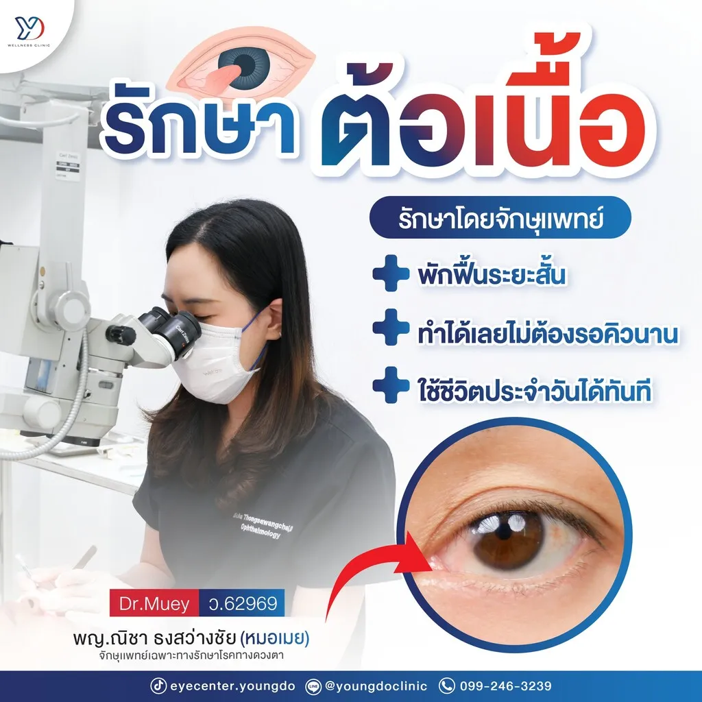 การรักษาต้อเนื้อโดยจักษุแพทย์