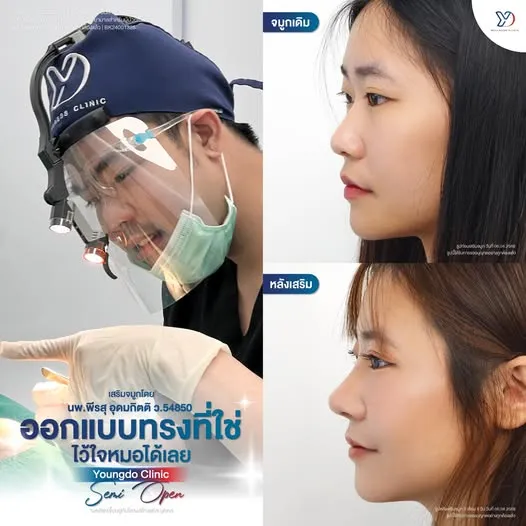 ออกแบบทรงที่ใช่ ไว้ใจหมอได้เลย Semi Open