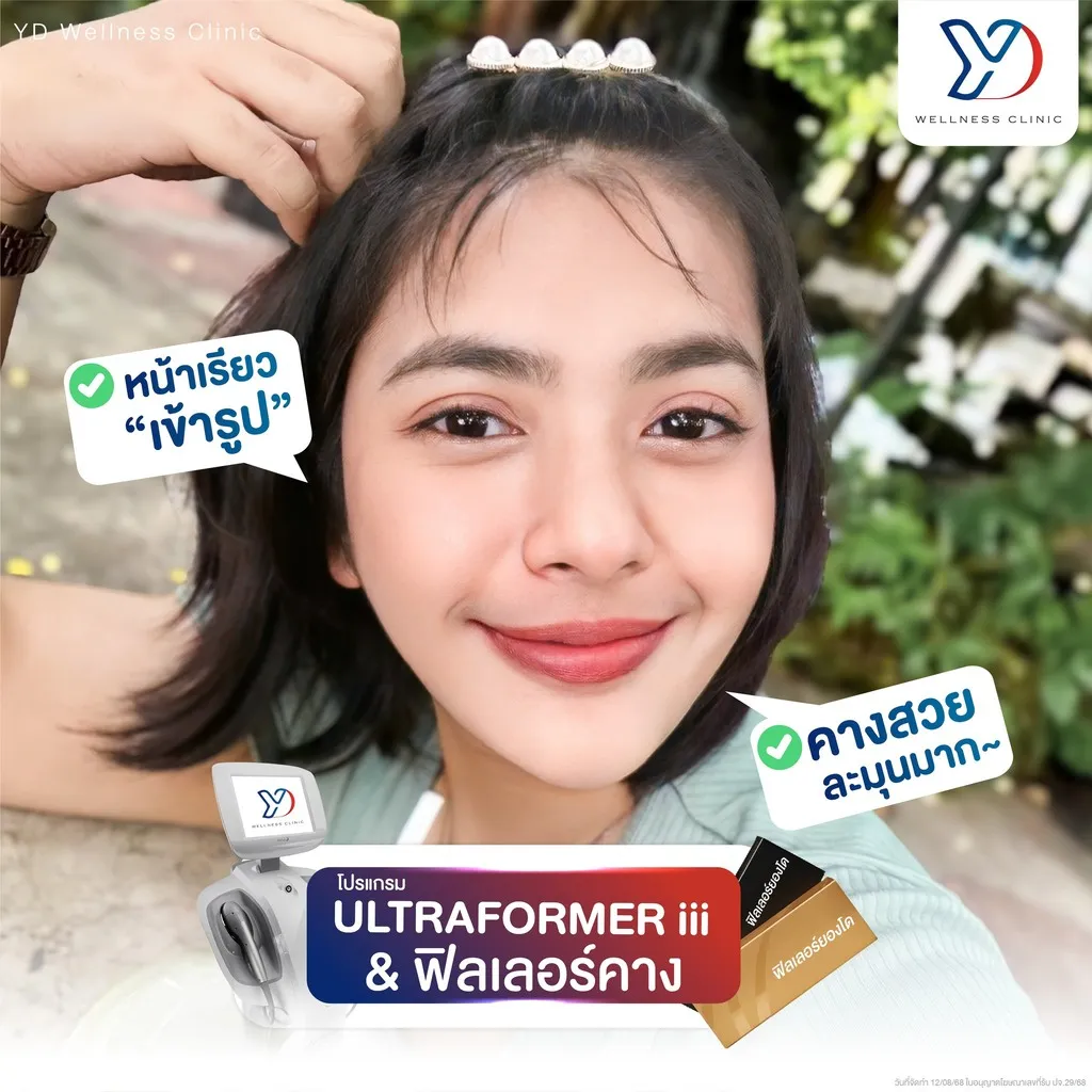 การปรับรูปหน้าด้วย Ultraformer และฟิลเลอร์คาง
