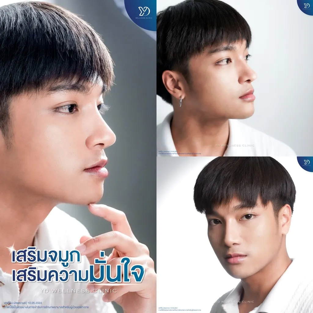 เสริมจมูกเสริมความมั่นใจ