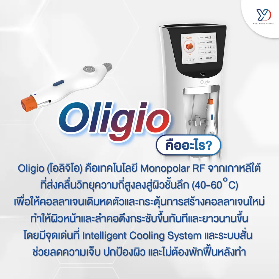 Oligio คืออะไร?