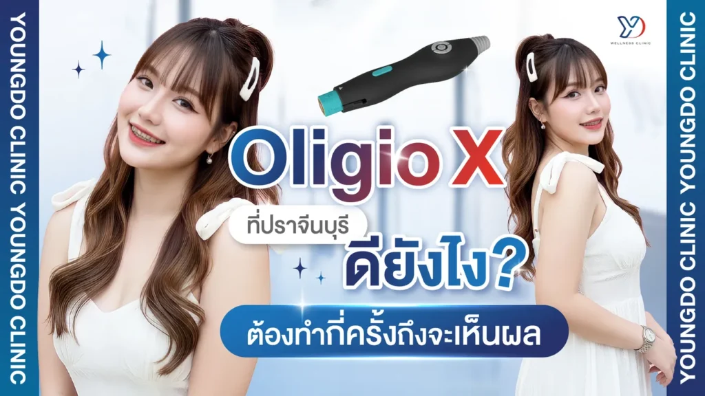 Oligio X ที่ปราจีนบุรี ดียังไง?