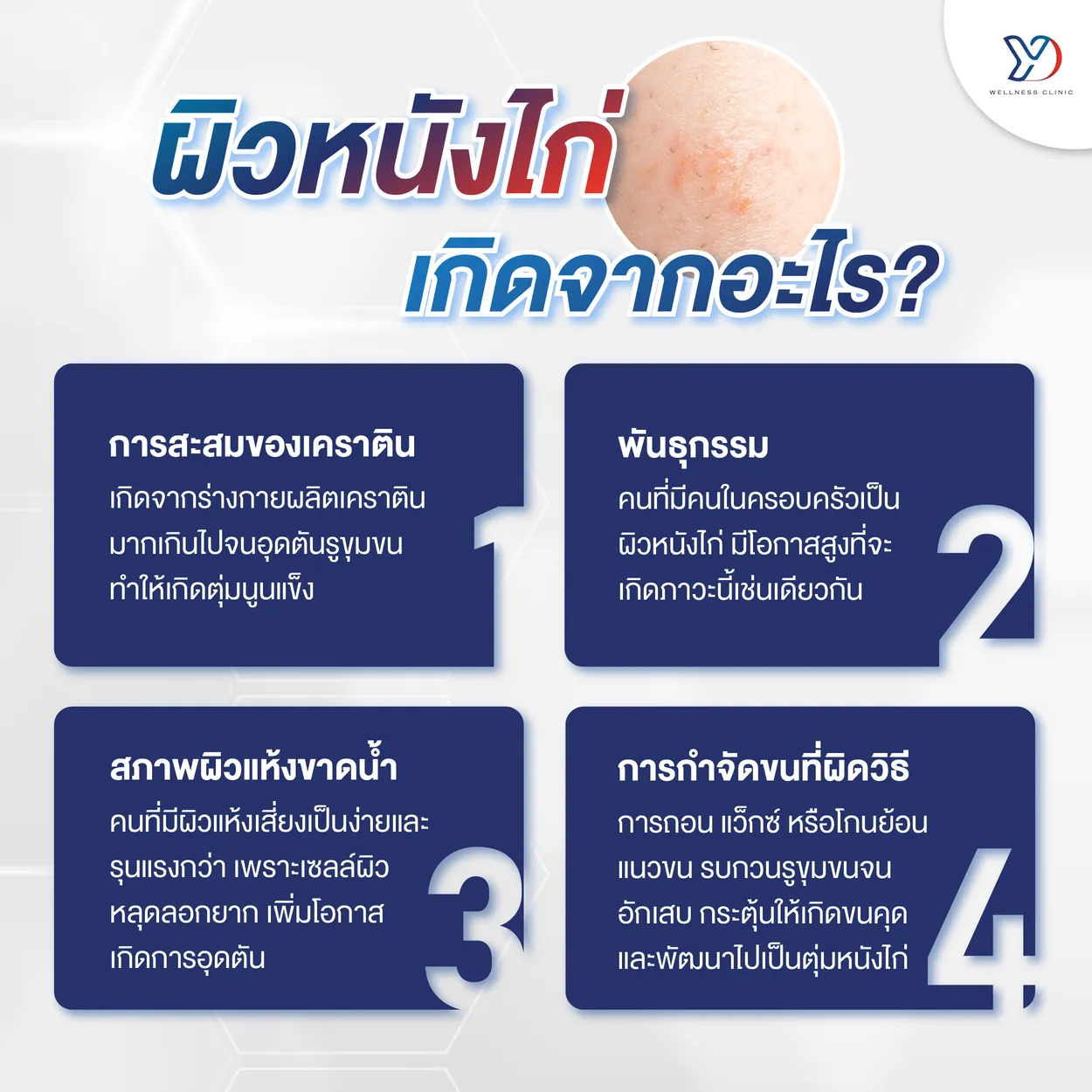 ผิวหนังไก่เกิดจากอะไร?