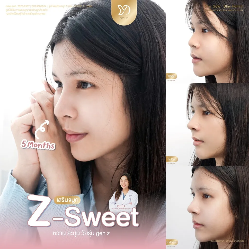 ความเปลี่ยนแปลงใน 5 เดือน