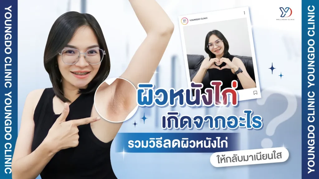 ผิวหนังไก่เกิดจากอะไร รวมวิธีลดผิวหนังไก่ ให้ผิวเนียนใส