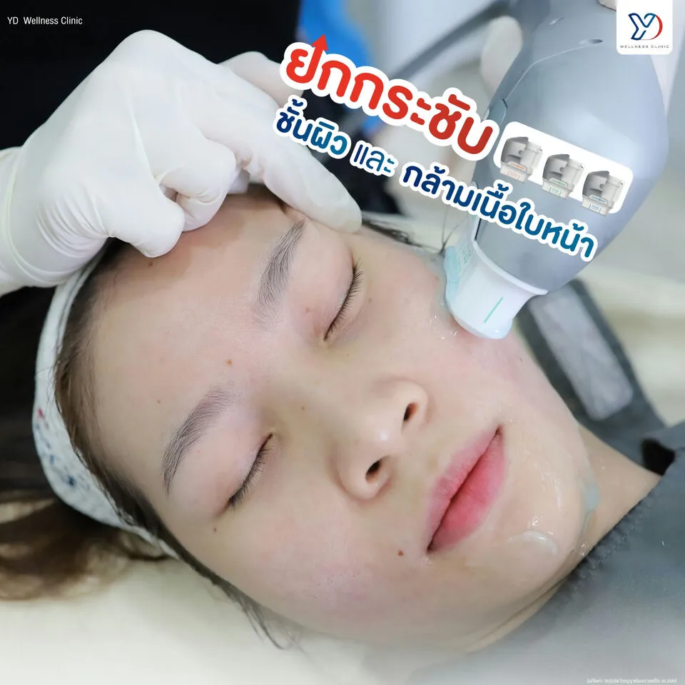 ยกกระชับชั้นผิวและกล้ามเนื้อใบหน้า