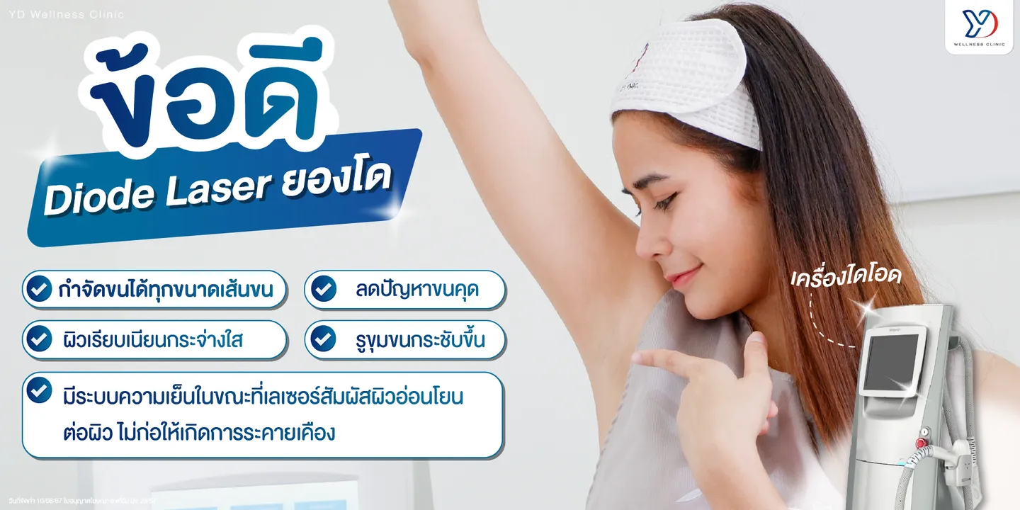 ข้อดีเลเซอร์ไดโอด