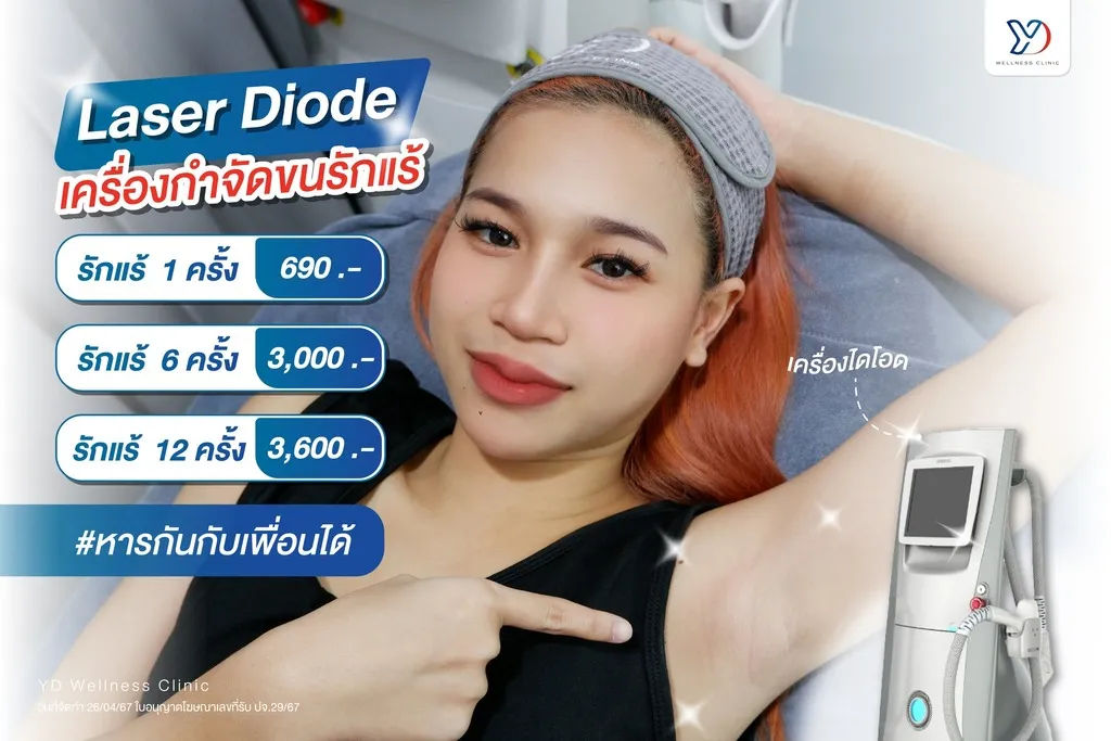 เลเซอร์ไดโอด ผิวใต้วงแขนเนียนใส