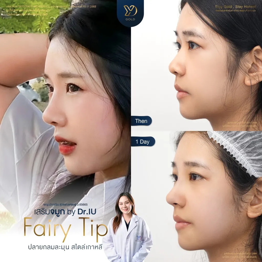 เทคนิคปลายพุ่งละมุนเกาหลี