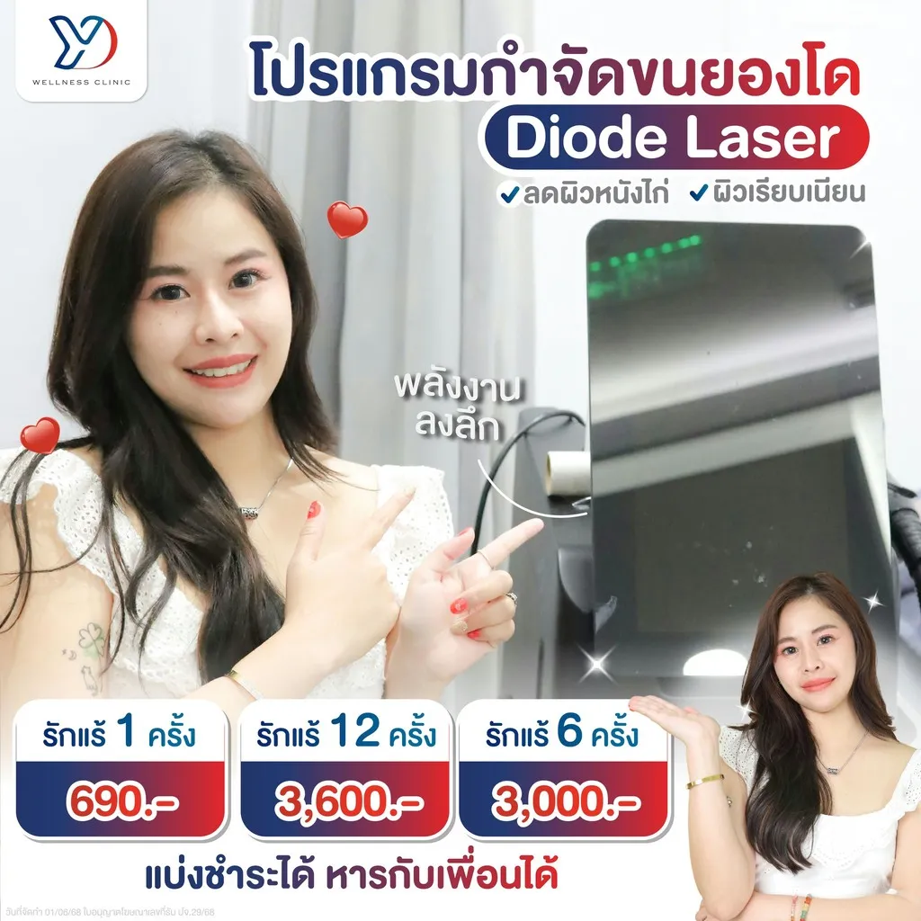 กำจัดขนเลเซอร์ราคาสุดคุ้ม