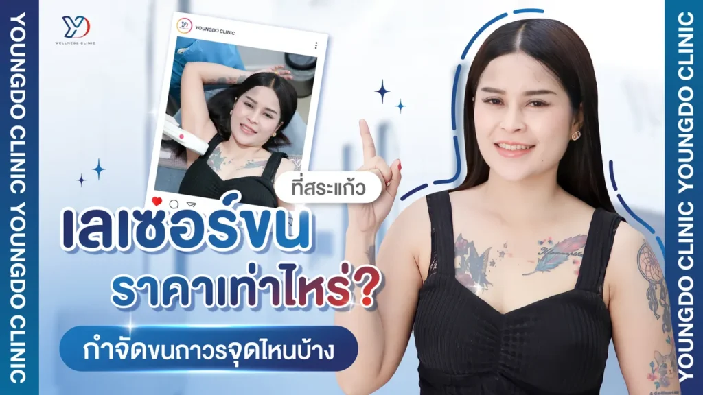 เลเซอร์ขน สระแก้ว ราคาเท่าไร กำจัดขนถาวรจุดไหนบ้าง