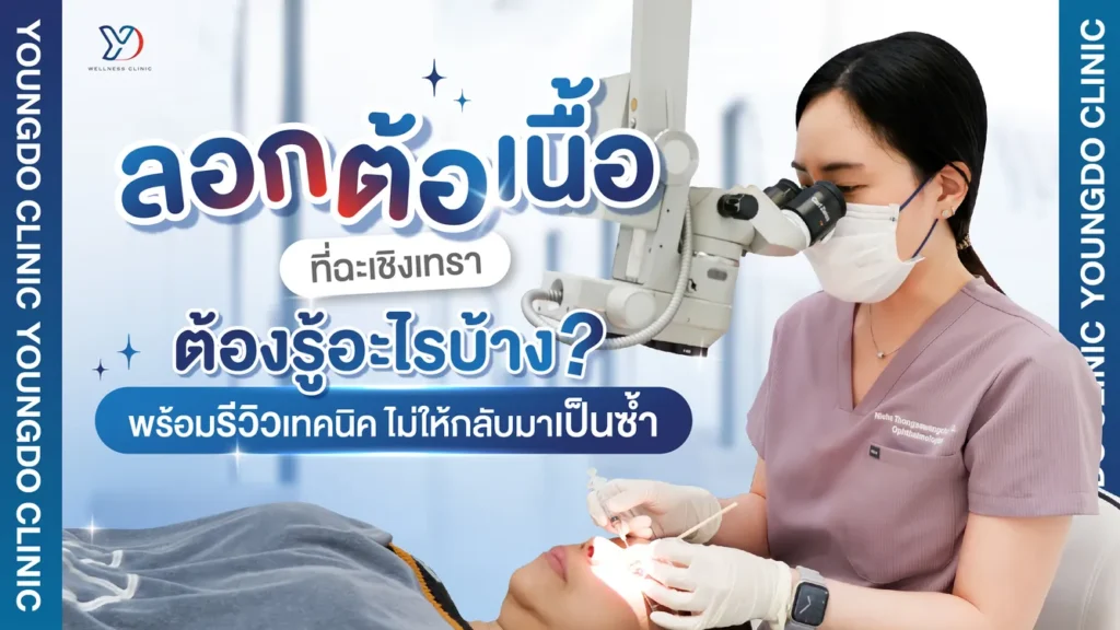 ลอกต้อเนื้อ ฉะเชิงเทรา เทคนิคปลูกถ่ายเนื้อเยื่อไม่กลับมาเป็นซ้ำ