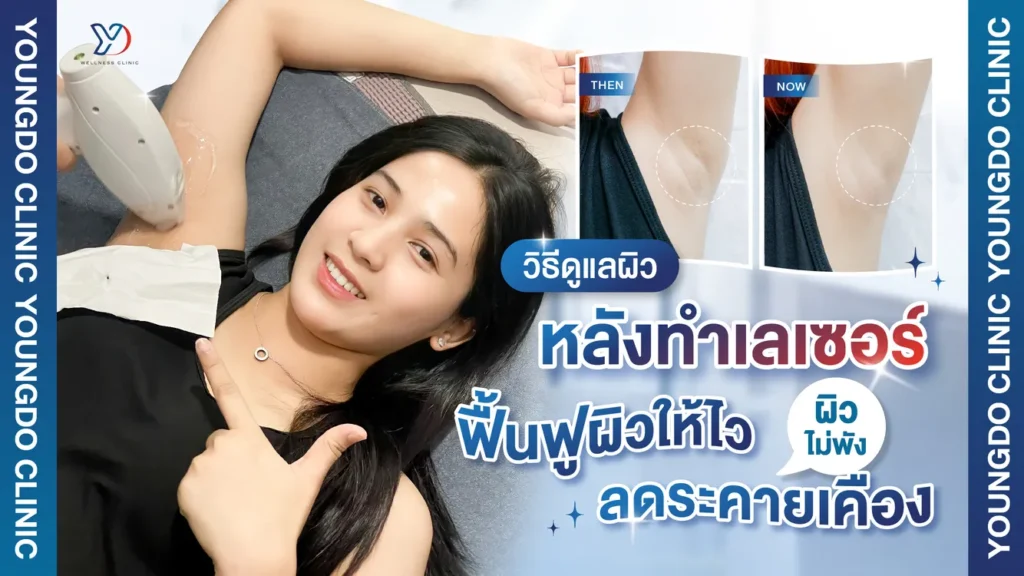 การดูแลผิวหลังทำเลเซอร์ ทำอย่างไรให้ผิวฟื้นไว ลดระคายเคือง ผิวไม่พัง