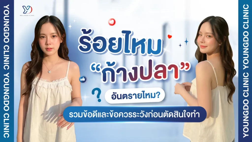 ร้อยไหมก้างปลา ข้อเสียมีอะไรบ้าง และอันตรายหรือไม่